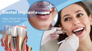 How Dental Implants in Las Vegas Can Transform Your Smile and Confidence